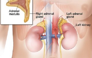 Μόρφωμα στα Επινεφρίδια